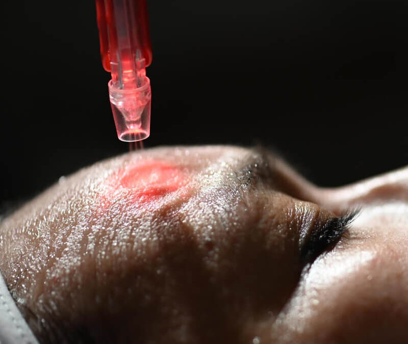 JetPeel uređaji u Studiju Namaste