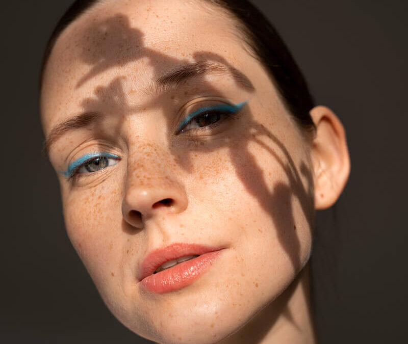 Nastanak i lečenje hiperpigmentacija