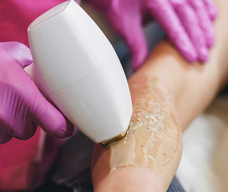 TRAJNA EPILACIJA I DEPILACIJA – PREDNOSTI, MANE I PREPORUKE