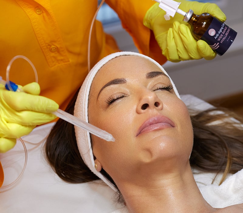 JetPeel tretman – Tretiranje različitih stanja kože